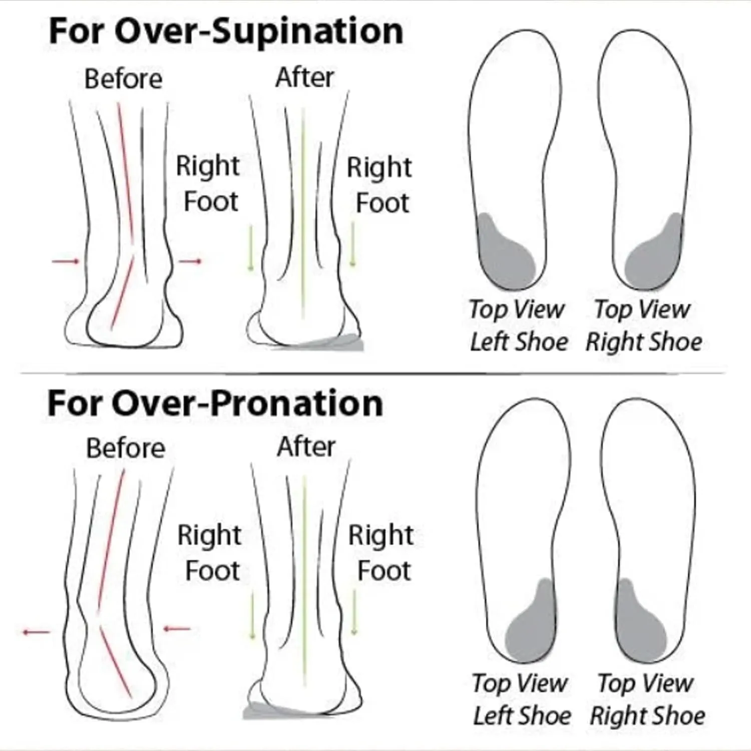 Women'S Soft Sole Mesh Comfort Orthopedic Shoes Mesh Orthopedic Shoes for Women Slip Ons